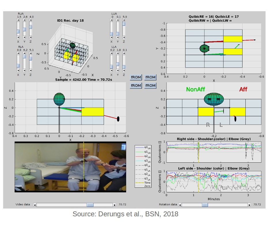 Towards entry "3D range of motion analysis"