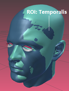 Towards entry "Temporalis muscle localization on 3D head models"